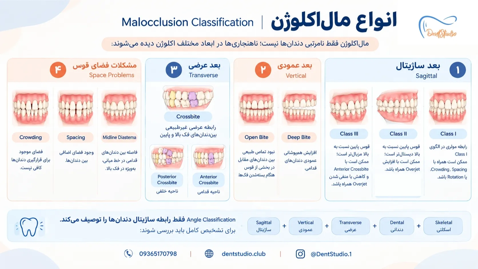 انواع مال اکلوژن
